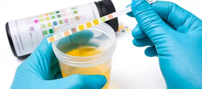 Antibiyotik Duyarlılık Testi Yaptırdınız Mı?
